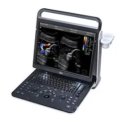 ULTRASONIDO PORTATIL, MODELO:  EBIT 60, MARCA: CHISON, CON 1 TRANSDUCTOR
